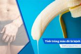 Tinh trùng có màu đỏ hồng là bệnh gì, nguy hiểm không?
