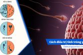 Tinh trùng yếu: Nguyên nhân và Cách điều trị