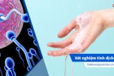 Những điều cần biết về xét nghiệm tinh trùng