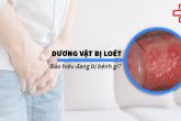 Dương vật bị lở loét biến chứng nguy hiểm