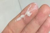 Viêm âm đạo do tạp khuẩn: Nguyên nhân và cách chữa trị hiệu quả