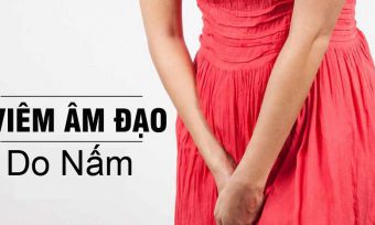 Viêm Âm Đạo Do Nấm