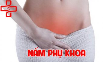 Thông tin cần biết về bệnh nấm phụ khoa ở nữ giới