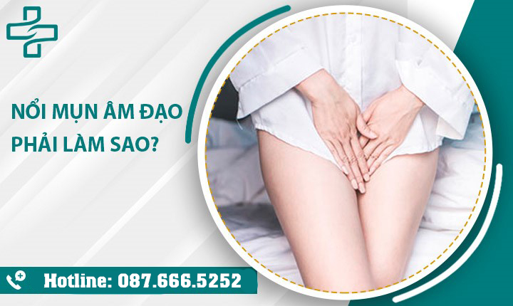 Nổi mụn âm đạo – 95% là dấu hiệu bệnh tình dục